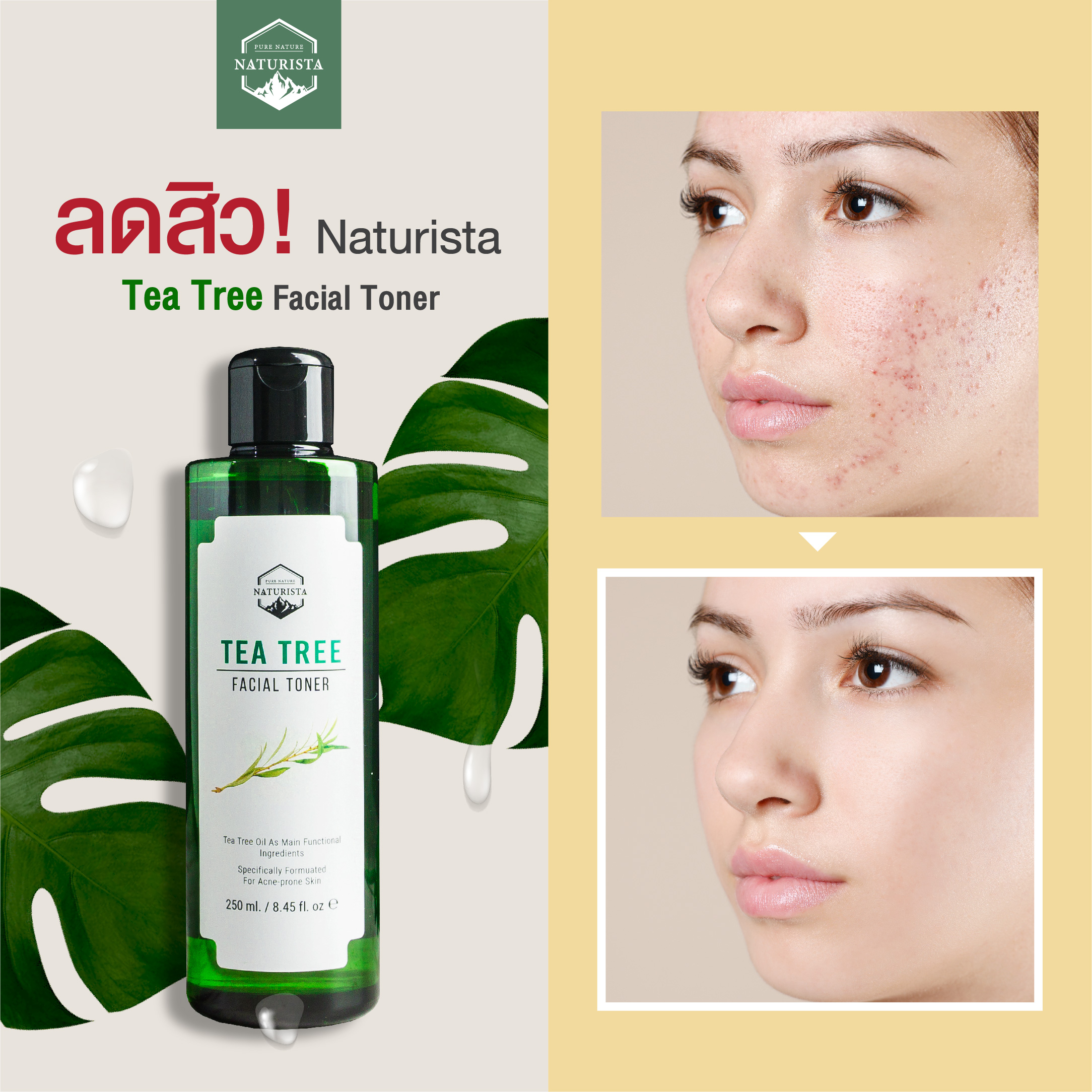 Naturista Tea Tree Facial Toner  ✓ Clinically Tested   ✓ Alcohol Free   ✓ Preservative Free   ✓ ECOCERT Organic    ปราศจากแอลกอฮอลล์ หากลูกค้าใช้แล้วรู้สึกเย็น เป็น Characteristic ของ Tea Tree Essential Oil   Tea Tree Essential Oil มีกลิ่นเฉพาะตัวที่ค่อนข้างฉุน ในสูตรจึงมีความจำเป็นที่ต้องมีน้ำหอมเกรดพิเศษ Allergen Free (ไม่ก่อให้เกิดการแพ้) ในปริมาณน้อยมาก เพื่อช่วยตัดกลิ่น Tea Tree ไม่ให้รู้สึกฉุนเกินไป โดยคนที่แพ้น้ำหอมในครีมอื่นๆ สามารถใช้ได้ค่ะ เนื่องจากมีความอ่อนโยนสูง